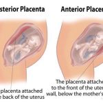 Pregnancy Journey: 04 Prenatal Visit (20 Minggu) – Fetal Anomaly Scan